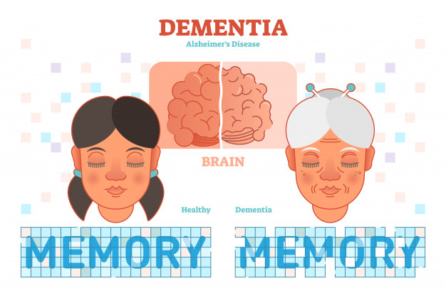 Alzheimer Hastalığı Hakkında Bilmeniz Gereken Her Şey